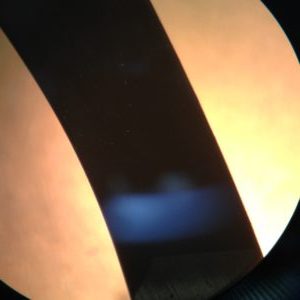 QDP shim micrograph